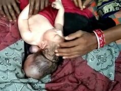 В Индии родился трехголовый младенец