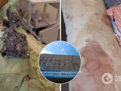 Житель Кривого Рога показал ужасные условия хирургии городской больницы: матрасы в моче и крови. Видео