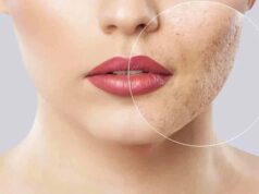 Шрамы на лице: как избавиться от них навсегда