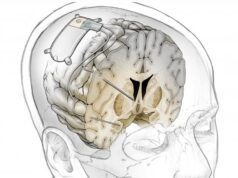 Экспериментальный мозговой имплант мгновенно избавит от неизлечимой депрессии