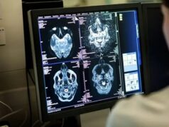 Коронавирус способен серьезно повреждать головной мозг