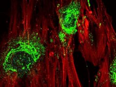 Звуковые волны превращают стволовые клетки в костную ткань