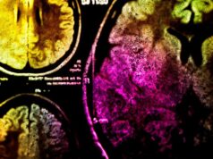 Фотоиммунотерапия поможет бороться с раком при помощи света