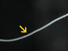 Ученые нашли самую крупную бактерию в мире — ее можно взять в руку