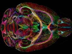 Ученые научились делать фантастически четкую МРТ мозга