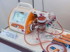 Российский прибор Life Stream Ecmo позволит оперативно восстановить кровообращение