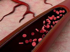 В Томске объявили о создании титановых кровеносных сосудов
