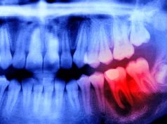 Японские ученые установили связь между здоровьем полости рта и мозга