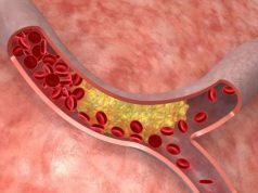 В Новосибирске создан полимер, предотвращающий разрывы сосудов