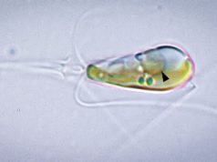 Редчайший случай в эволюции – две формы жизни слились в единое целое