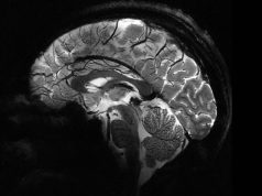 Самый мощный в мире МРТ-аппарат Iseult в несколько раз превзошел конкурентов