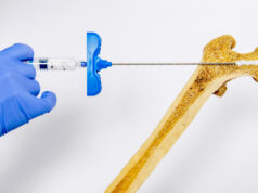 Инъекции костного геля помогут победить остеопороз