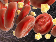 Комбинация двух препаратов снижает уровень холестерина в крови на 49 %