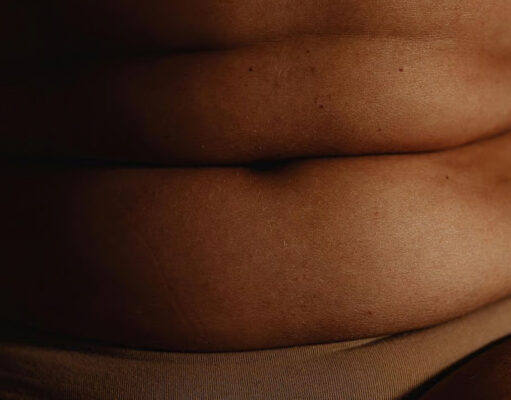 Один укол препарата MariTide от Amgen в месяц снижает вес на 16 процентов