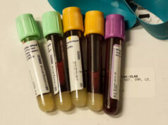 В Стэнфорде разработали анализ крови для определения скорости старения отдельных органов