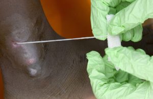 Человечество в шаге от полной победы над второй (после оспы) инфекционной болезнью в истории