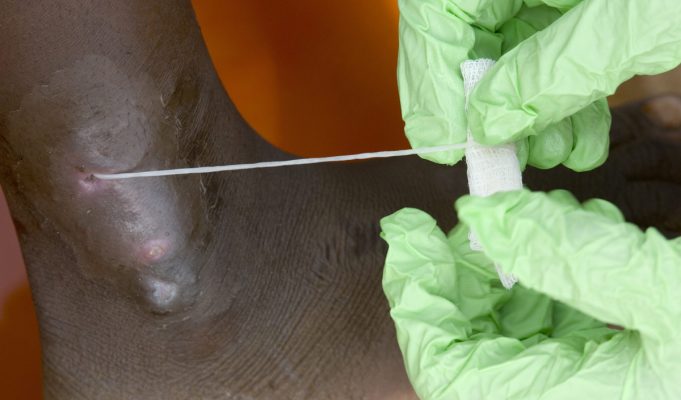 Человечество в шаге от полной победы над второй (после оспы) инфекционной болезнью в истории